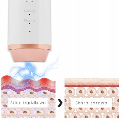 Ултразвучна шпатула Beautifly B-Plasma Pro, мултифункционална, за чистење на лице