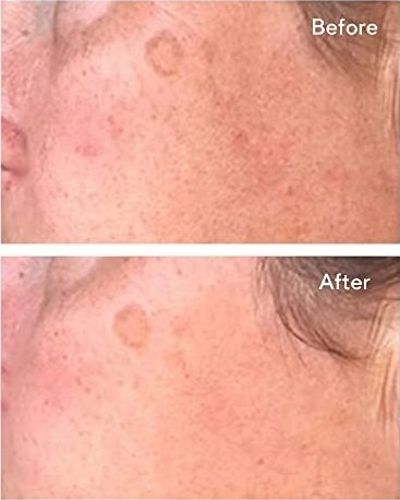 Крем за лице Murad Exclusive Correct and Protect, SPF45 PA++++, 30ml
