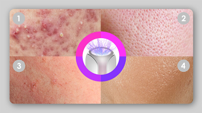 Уред за нега на кожа Beauty Relax PlasmaForce