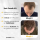 Set për flokë Mansera Serum Minoxidil 5%, 50ml + aplikator smart