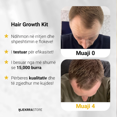 Set për flokë Mansera Serum Minoxidil 5%, 50ml + aplikator smart
