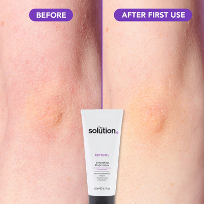 Losion për trup The Solution Retinol Smoothing Body Lotion, 200ml