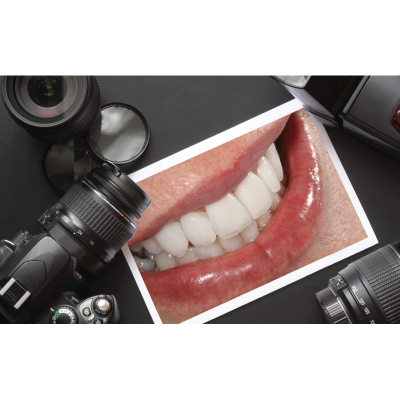 Set fotografik dentar – Kamerë & Dritë ring
