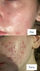 Serum kundër rrudhave The Ordinary Retinol 1% in Squalane, 30ml