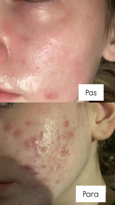 Serum kundër rrudhave The Ordinary Retinol 1% in Squalane, 30ml