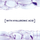 Xhel për fytyrë L'Oreal Hyaluron Specialist Skin, 50 ml