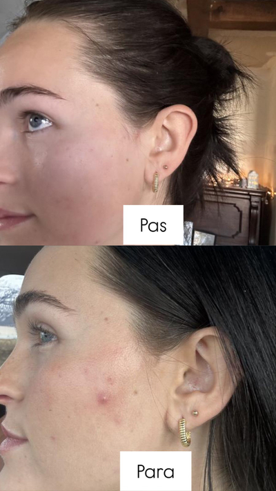 Serum për fytyrë kundër rrudhave The Ordinary Retinol 0.5% in Squalane, 30ml