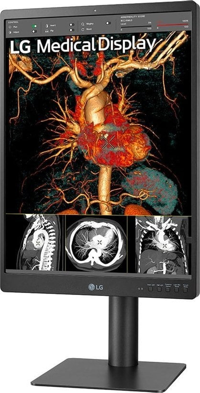 Monitor diagnostik LG 21HQ513D, 21.3", 3MP IPS, 1536x2048, i bardhë