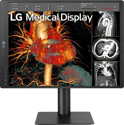 Monitor diagnostik LG 21HQ513D, 21.3", 3MP IPS, 1536x2048, i bardhë