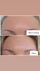 Serum për rrudha The Ordinary Argireline Solution 10%, 30ml