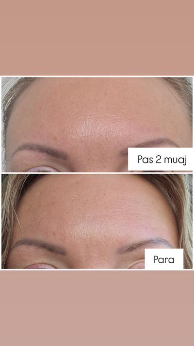 Serum për rrudha The Ordinary Argireline Solution 10%, 30ml