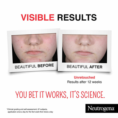 Serum Neutrogena Clear & Defend+ (Daily Serum), 30 ml