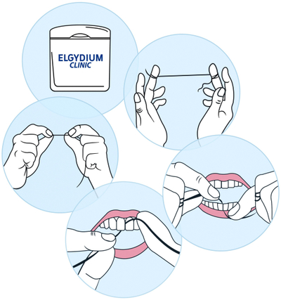 Забен конец Elgydium Orthodontic Crossing Floss, арома нане, 30 парчиња