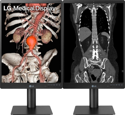 Monitor diagnostik LG 21HQ513D, 21.3", 3MP IPS, 1536x2048, i bardhë