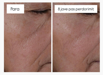 Serum kundër rrudhave The Ordinary Multi-Peptide + HA (“Buffet”), 30ml