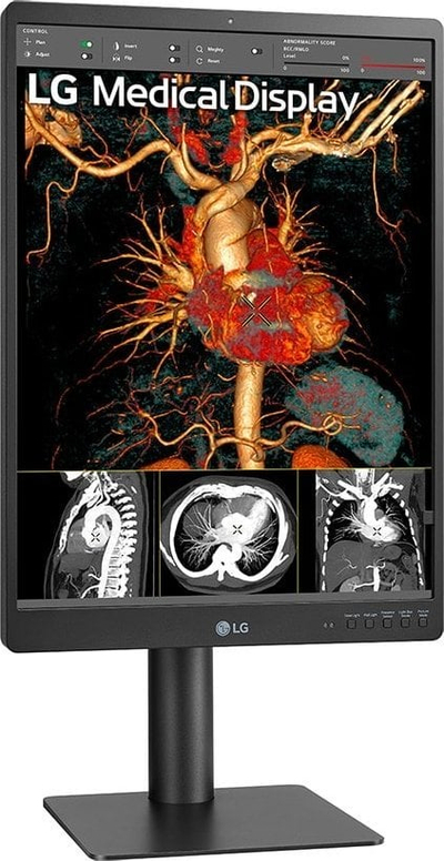 Monitor diagnostik LG 21HQ513D, 21.3", 3MP IPS, 1536x2048, i bardhë