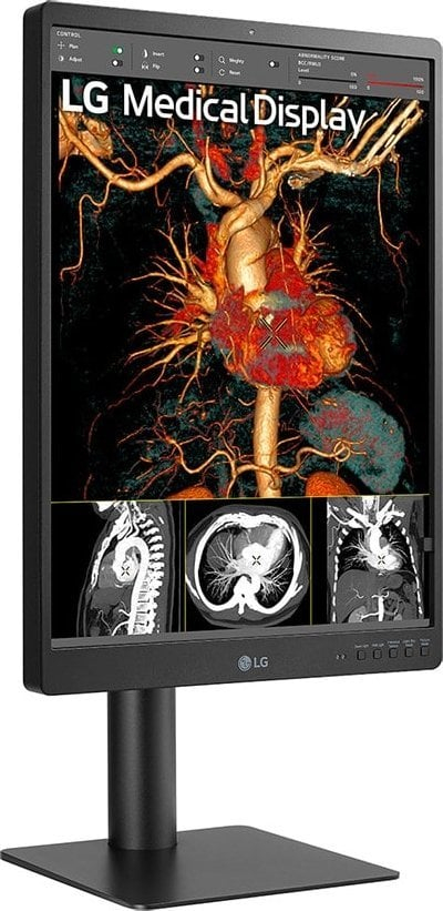 Monitor diagnostik LG 21HQ513D, 21.3", 3MP IPS, 1536x2048, i bardhë