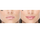 Shkëlqyes për buzë FacEvolution LipPlus Booster 5 ml