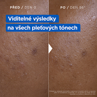 Krem për fytyrë Mixa Niacinamide Bright Moisturizing Anti-Dark Spot Cream, 400 ml