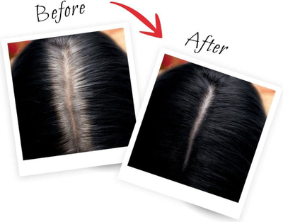 Sprej për rrënjët e flokëve L’Oreal Paris Magic Retouch No. 1, 75 ml, i zi