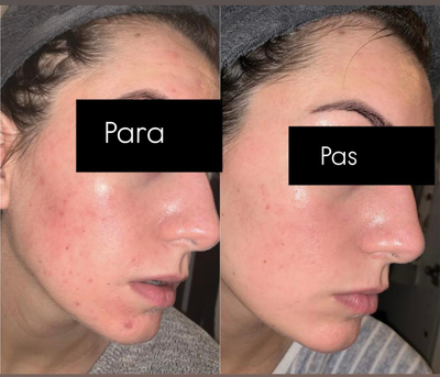 Serum kundër rrudhave The Ordinary Retinol 1% in Squalane, 30ml