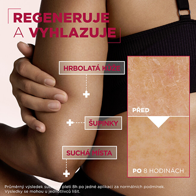 Krem për trup Mixa Urea Cica Repair+ Renewing Cream, 150 ml
