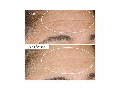 Krem për fytyrë StriVectin Advanced Retinol, 30 ml