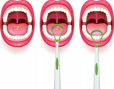 Pastrus gjuhe PIKSTERS Tongue Cleaner, kokë e vogël, plastik, transparent