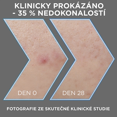 Serum për fytyrë Garnier AHA + BHA Charcoal, 30 ml