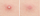 MIZON Good Bye Blemish Clear Patch, 44 Фластери