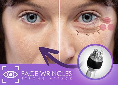 Pajisje estetike për lëkurë BeautyRelax Skinlift