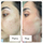 Serum kundër akneve The Ordinary Salicylic Acid 2%, 30ml