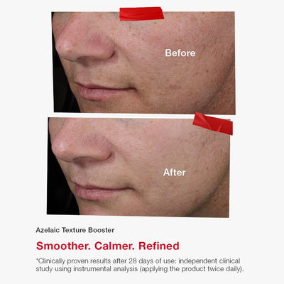 Serum për fytyrë SkinCode Essentials Azelaic Texture Booster, 30ml