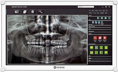 Monitor AG Neovo DR-2202, 21.5", Full HD, i bardhë