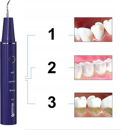 Pastrues dentar ultrasonik OROMED ORO SCAL DENT, 3 nivele intensiteti, karikim USB C, i bardhë