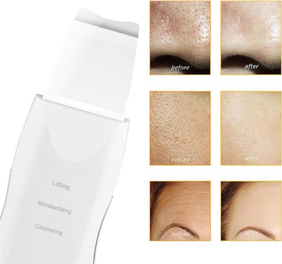 Pajisje për peeling kavitacional Aptel AG207F, wireless, për fytyrë, e bardhë