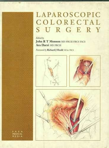 Laparoscopic Colorectal Surger - Richard J. Heald