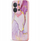 Mbulesë telefoni Tech-Protect Icon, Xiaomi Redmi 15C POCO C85, silikon, me model mermeri