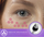 Pajisje estetike për lëkurë BeautyRelax Skinlift